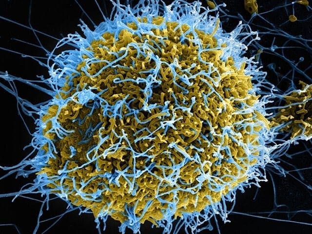 Chematria is using artificial intelligence to search for new Ebola treatments